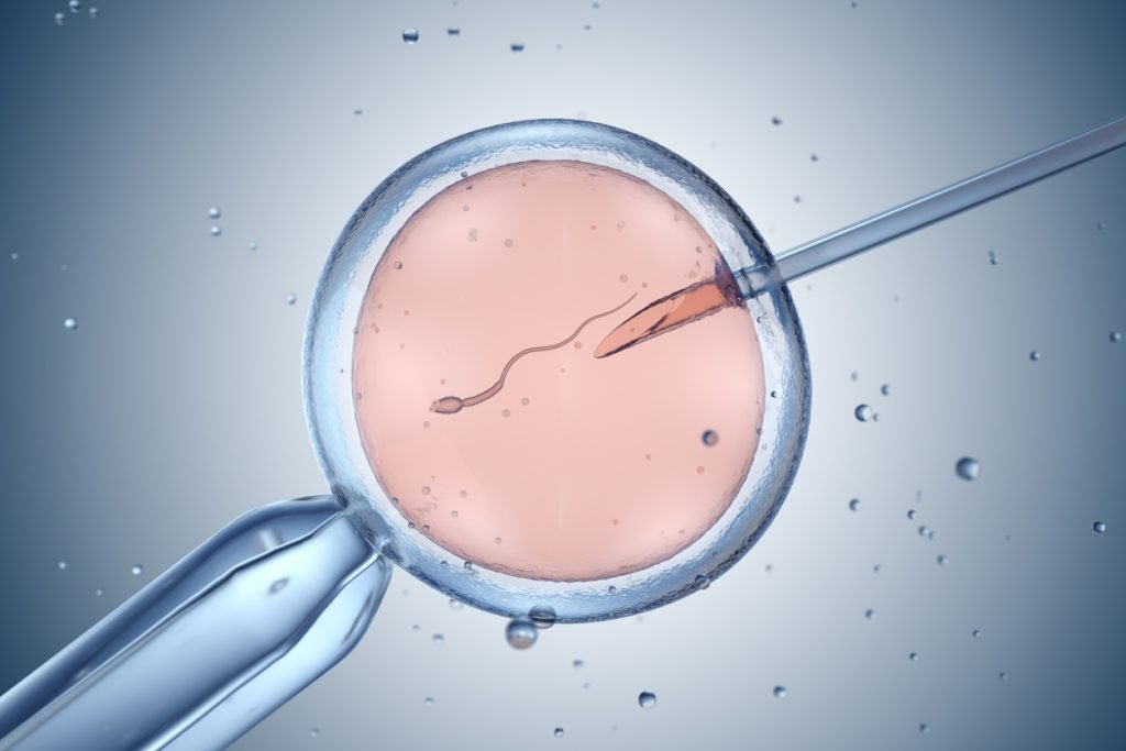 ICSI IVF