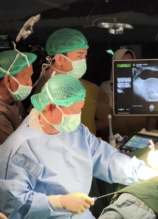 Demonstrasi teknologi radiofrequency ablation untuk mioma uteri