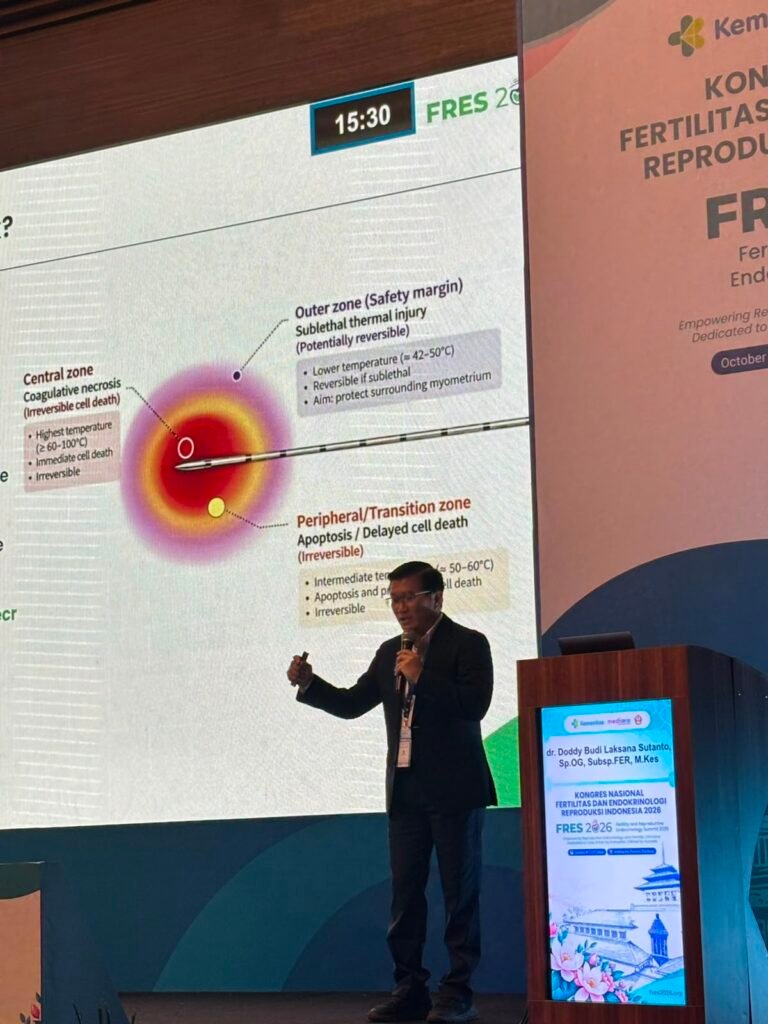 dr. Doddy Sutanto presentasi RFA mioma dan adenomiosis pada Simposium Nasional FRES 2026 dr. Doddy Sutanto presentasi RFA mioma dan adenomiosis pada Simposium Nasional FRES 2026